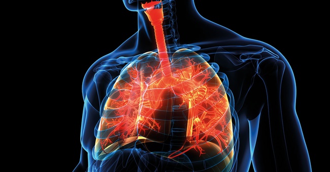Von der Lungenkrankheit COPD sind in Österreich ca. 11 %  der über 40-Jährigen betroffen. Die mit Husten, Atemnot und Leistungsschwäche einhergehende Erkrankung wird oft nicht ernst genommen oder als harm­- loser Raucher­husten abgetan. © iStock