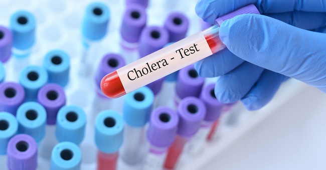 Cholera-Test © Shutterstock