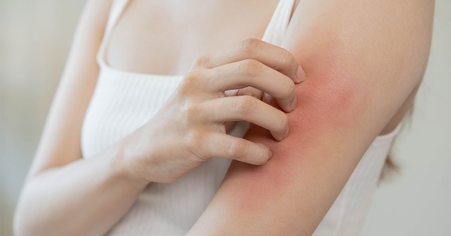 Frau mit Hautreaktion © Shutterstock