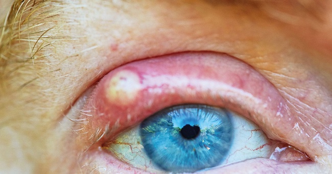 Auge © iStock