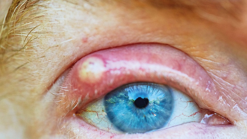 Auge © iStock