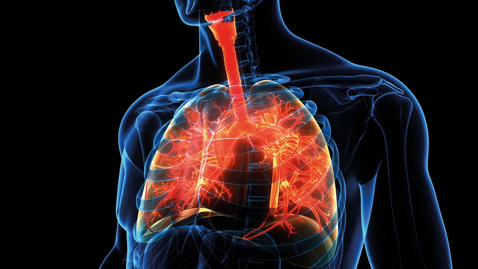 Von der Lungenkrankheit COPD sind in Österreich ca. 11 %  der über 40-Jährigen betroffen. Die mit Husten, Atemnot und Leistungsschwäche einhergehende Erkrankung wird oft nicht ernst genommen oder als harm­- loser Raucher­husten abgetan. © iStock