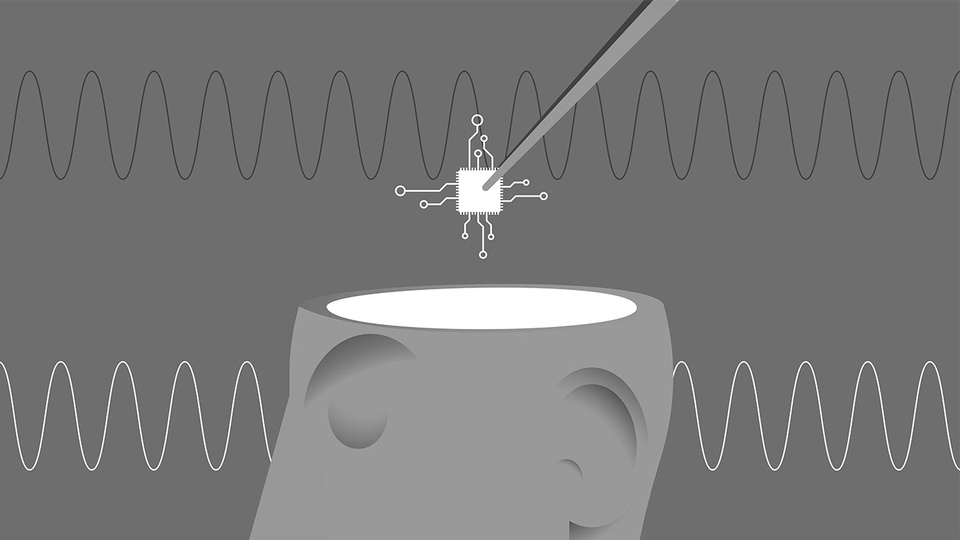 Comichafte Darstellung vom Einsetzten eines Mikrochips in das menschliche Gehirn. © iStock