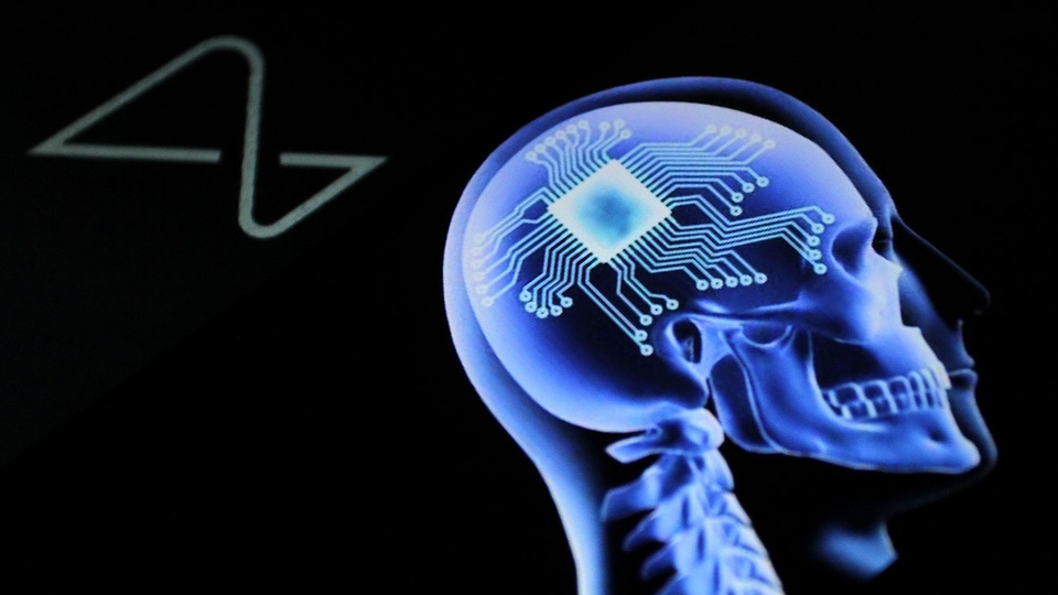 Neuralink © Shutterstock